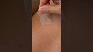 That time of the year #satisfyingvideo #sunburn #skincare #asmr #sunscreenalways