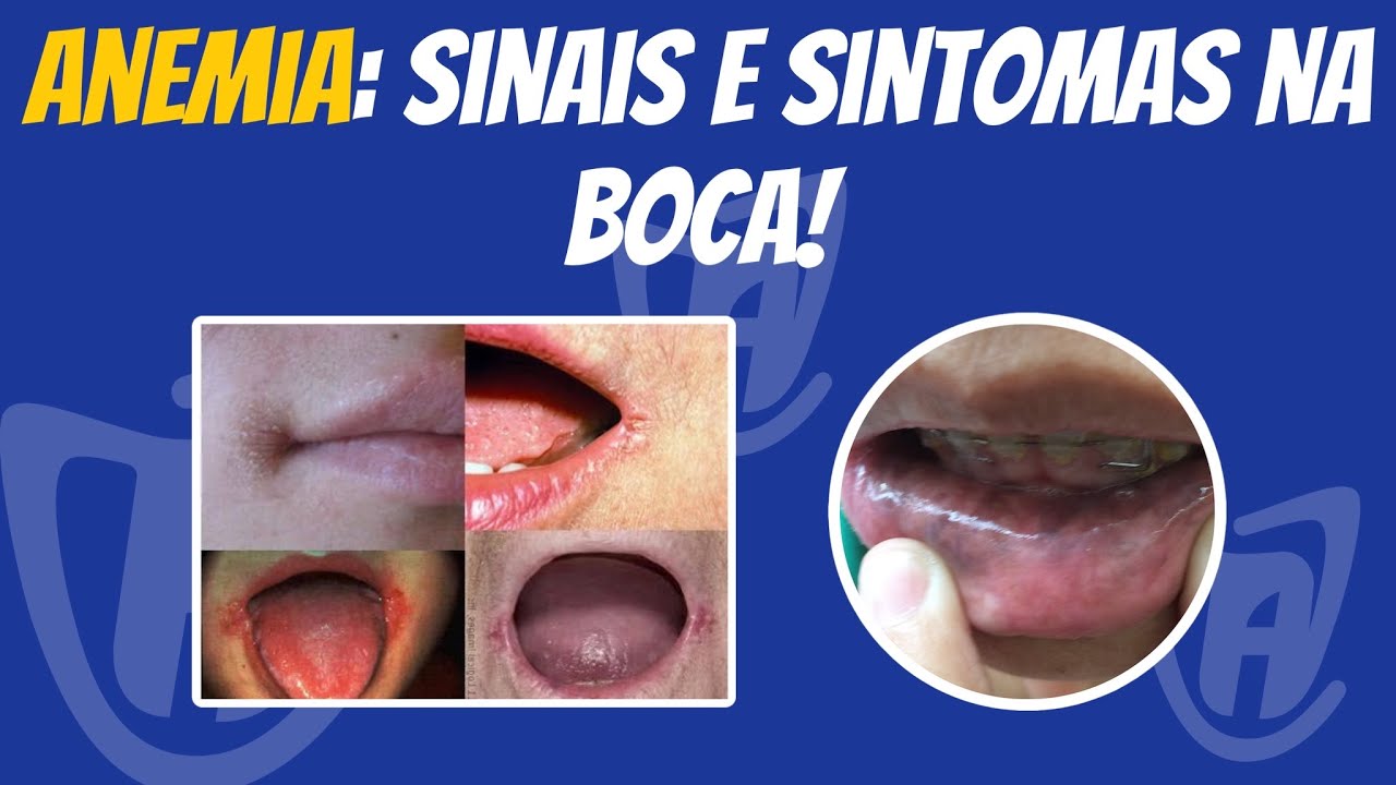 Francisco De Assis Almeida Lima Júnior-83