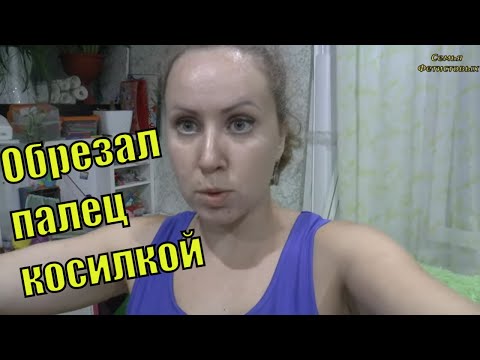 Травма у Саши. Урожай в Агрощите. Уборка после поездки/ Семья Фетистовых