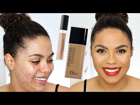 Dior Undercover Foundation Review (oily skin/acne) | samantha jane Video