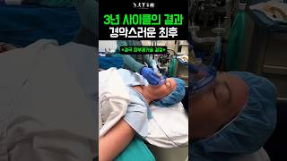 유튜브 썸네일