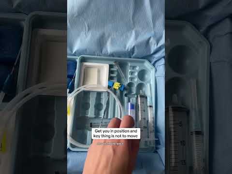 My favourite procedure as an anesthesiologist 🫶💉👩🏻‍⚕️ #epidural #anesthesia #pregnancyeducation