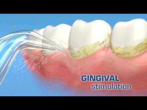 download lagu mp3 mp4 Idropulsore Per Denti, download lagu Idropulsore Per Denti gratis, unduh video klip Idropulsore Per Denti