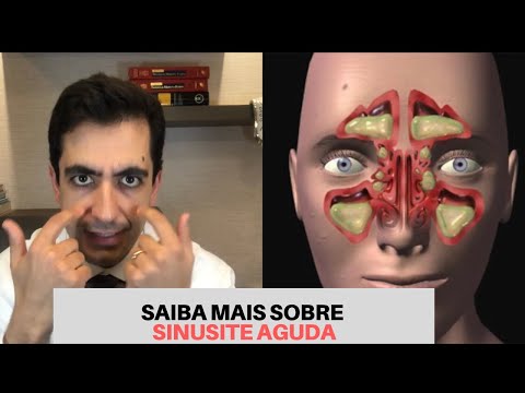 SINUSITE AGUDA: Precisa de antibiótico? / Dr. Paulo Mendes Jr - Otorrino em Curitiba