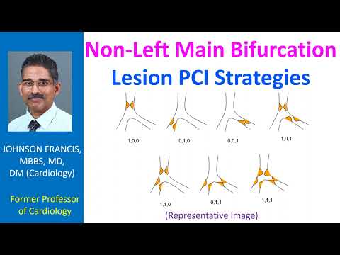 Non-Left Main Bifurcation Lesion PCI Strategies