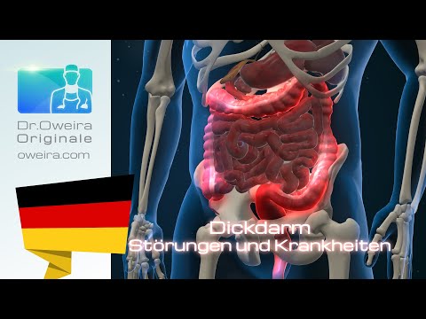 Reise durch einen gesunden Dickdarm - Teil 2: Beschwerden und Krankheiten