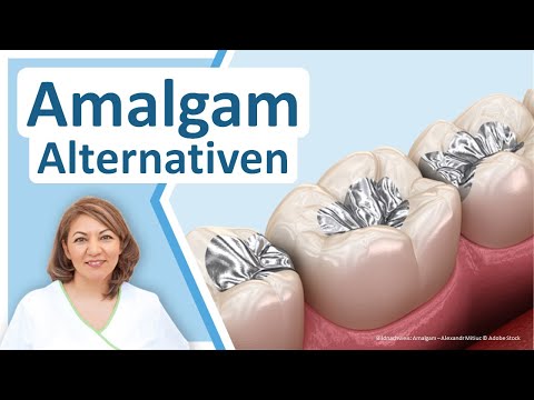 Amalgam-Alternativen bei Zahnfüllungen und Inlays | Zahnärztin N. Redjai Grossostheim-Pflaumheim