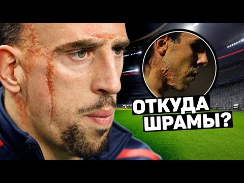 ЖУТКИЕ ШРАМЫ ФУТБОЛИСТОВ. Шокирующие истории шрамов Рибери, Тевеса и др. Футбольный топ @120 ЯРДОВ