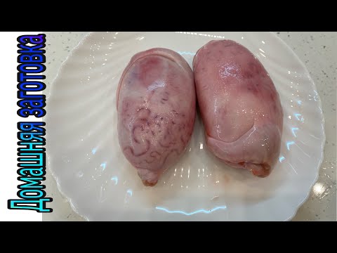 Nuci de la varicose Golfurile veneila împotriva