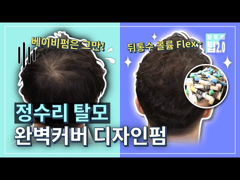 정수리 탈모 공식을 깬 펌 신공