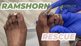 Ramshorn Rescue | Comforting Nail Trim