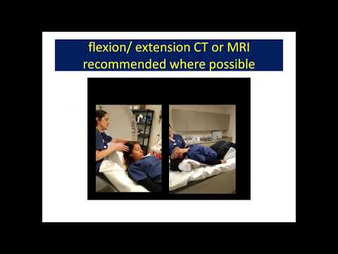 EDS ECHO Clinicians North America (CLN3A), Session 4
