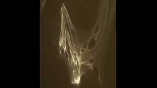 Imminent Starvation - Not Human II
