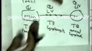 general pathology 18 :TUBERCULOSIS 2  DR SAMEH GHAZY