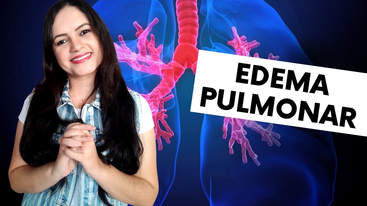 Edema Agudo de Pulmão e os cuidados de Enfermagem (Profª Juliana Mello)