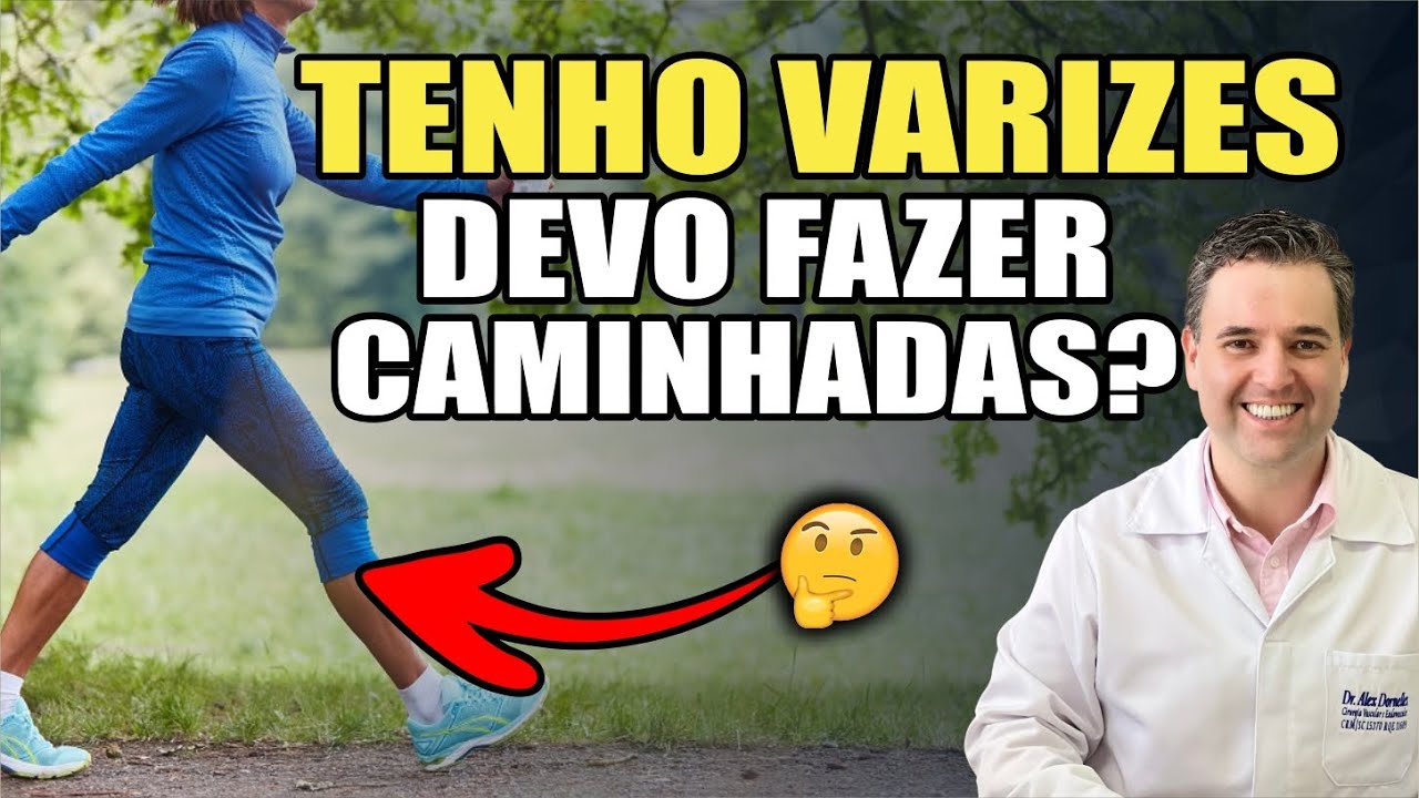 Quem tem má circulação deve praticar caminhadas? Saiba mais sobre má circulação nas pernas.