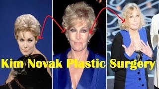 Kim Novak Plastic Surgery Before and After