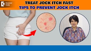 Jock Itch (Tinea Cruris)| Best ways to avoid Itching Down There - Dr. Rasya Dixit| Doctors