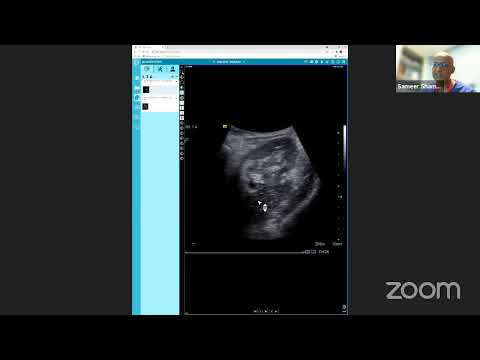 FRCR 2B Practice VIVA with Dr Sameer Shamshuddin