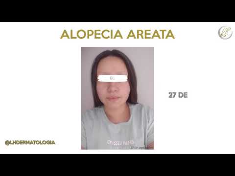 video sKE4b1zbzts