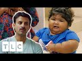 Congenital Leptin Deficiency Makes Toddler Eat Non Stop L Body Bizarre