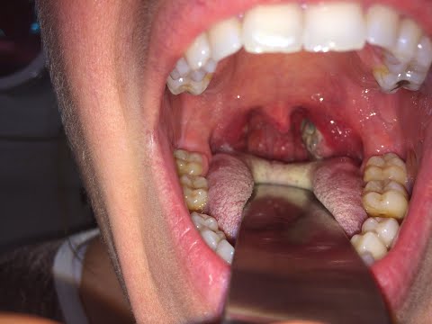 Examination of The Oral Cavity