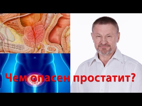 Qual è il drenaggio della prostata Il cancro alla prostata e testicoli