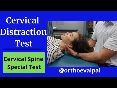 Positive Hoffman s Sign Hyperreflexia and Spurling s Test