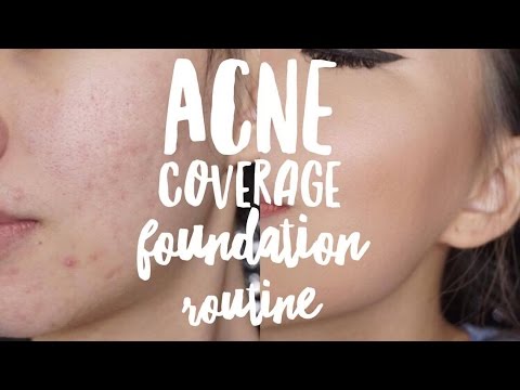 ACNE COVERAGE FOUNDATION ROUTINE || BAHASA INDONESIA