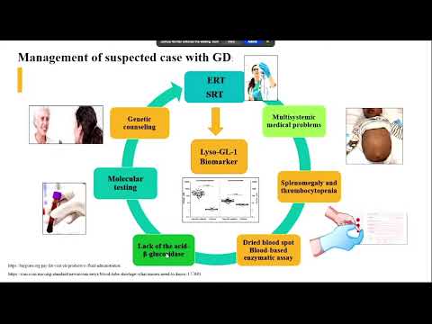 Wondering Hepatosplenomegaly? Not Always a Malignancy – Dr. Maha Faden (May 26-27, 2023)
