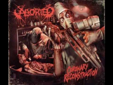 Download Aborted Coronary Reconstruction Mp3 dan Mp4 2018