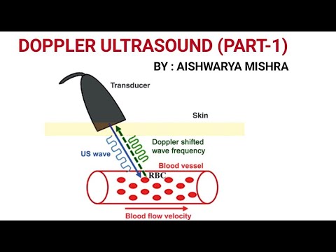 DOPPLER ULTRASOUND  (PART-1)||  BY : AISHWARYA MISHRA