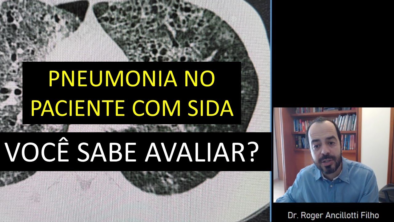 TOSSE NO PACIENTE COM AIDS. COMO ESTÁ A TOMOGRAFIA DE TÓRAX? SERÁ PNEUMOCISTOSE?