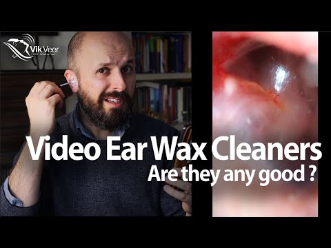 Ear Surgeon Reviews Home Ear Wax Removal Cameras