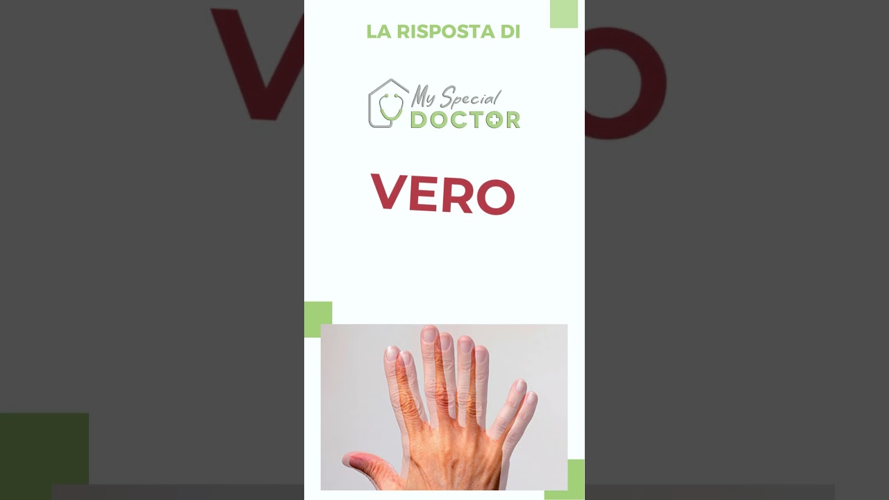 63 - La visione doppia (diplopia) non va mai trascurata?  - My Special Doctor