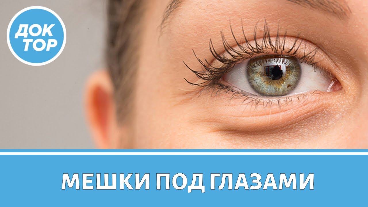 О каких заболеваниях сердца говорят мешки под глазами