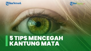 5 Tips Ampuh Mencegah Terjadinya Kantung Mata, Gunakan Minyak Zaitun hingga Hindari Kopi