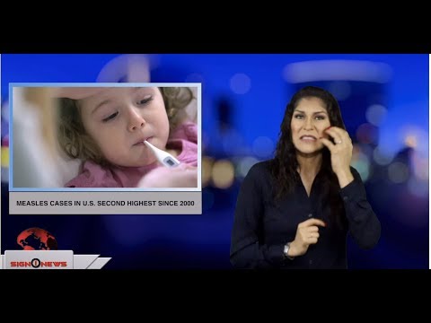 Measles cases in U.S. second highest since 2000 (ASL - 4.2.19)