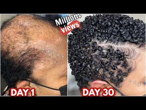 how I treat repair my damaged hair with one ingredient and here is my 30 day results