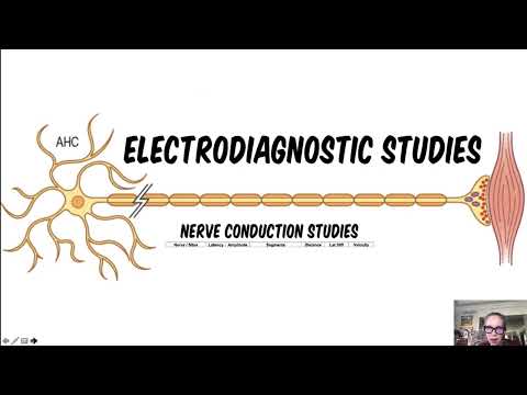 Video 21 Strategies For Treatment Of Lower Extremity Nerve Injuries