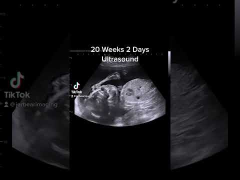 20 weeks 2 day’s Ultrasound #jerbearimaging #ultrasound www.JerBearImaging.com