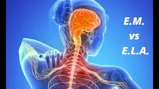 Diferencias entre Esclerosis múltiple y E.L.A.