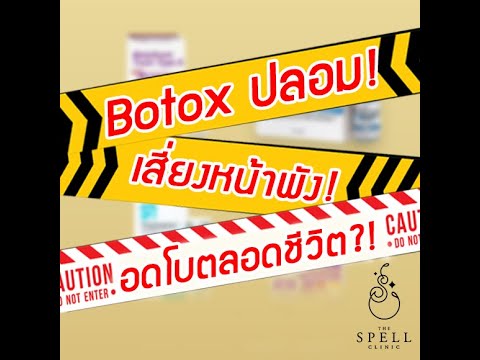เมโสแฟต ยี่ห้อไหนดี