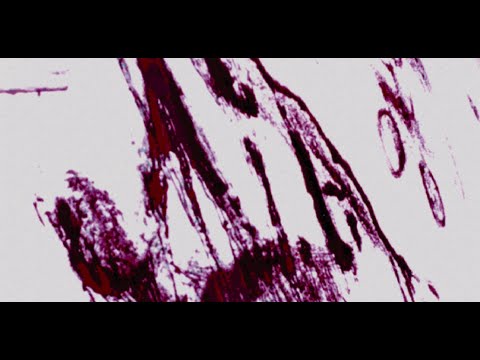 [FREE] DARK X SCARLXRD X ATV2 TYPE BEAT - "PALE FACE" (prod. M!ST)