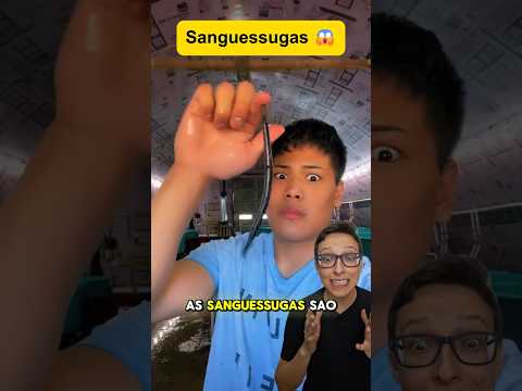 Sanguessugas 😱#medicina #medico #enfermagem #enfermeiro #enfermeira #professor #curiosidades