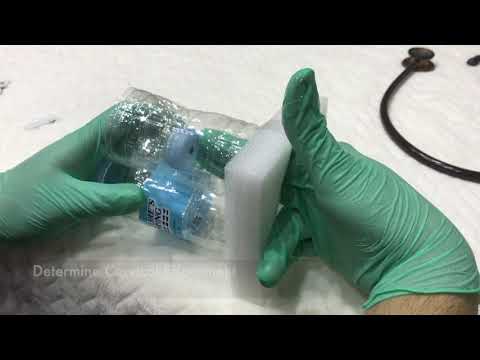 Cervix Internal Examination (OB Retdem)