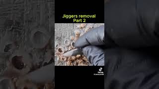 jiggers removal #satisfyingvideo #satisfying