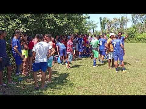 PORTUGUESA 1X1 JUVENTUS