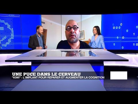 Hypertension artérielle rénale Fraction potable était 2 TSA pour lhypertension