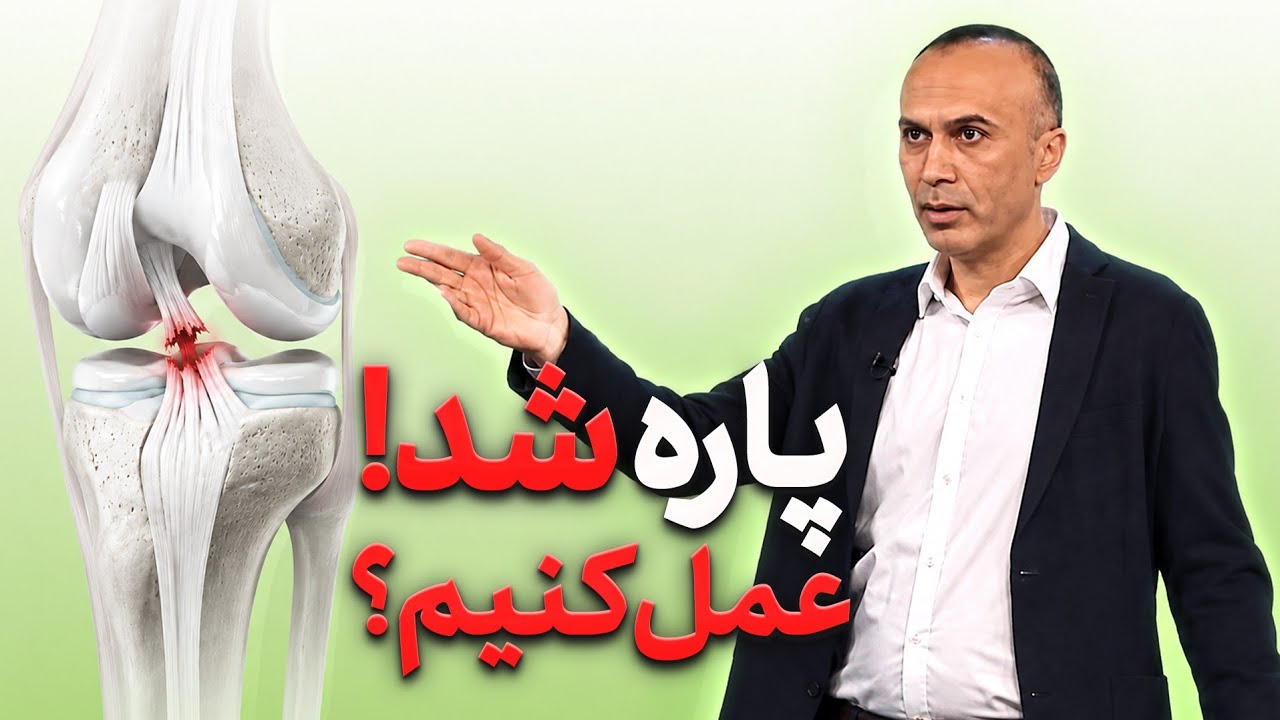 پارگی رباط صلیبی؛ چه زمانی جراحی لازم است؟ | ACL و آسیب زانو